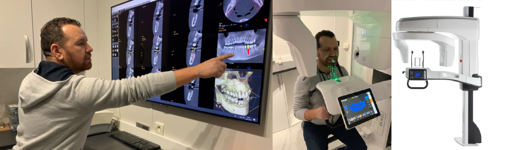 Nouvelle machine Carestream dental CS9600 installée par nos soins